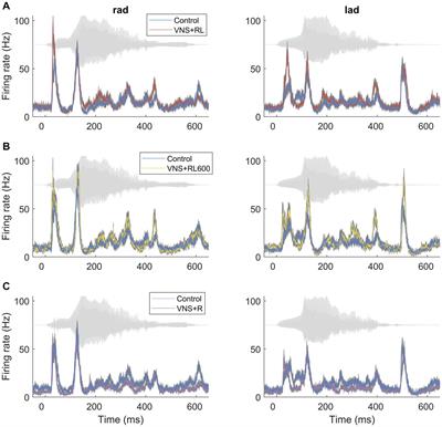 Precise sound characteristics drive plasticity in the primary auditory cortex with VNS-sound pairing